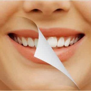Ini 7 Cara Mencerahkan Bibir Dengan Cepat