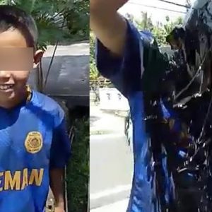 Polisi Selidiki Kasus Bocah Disiram Oli