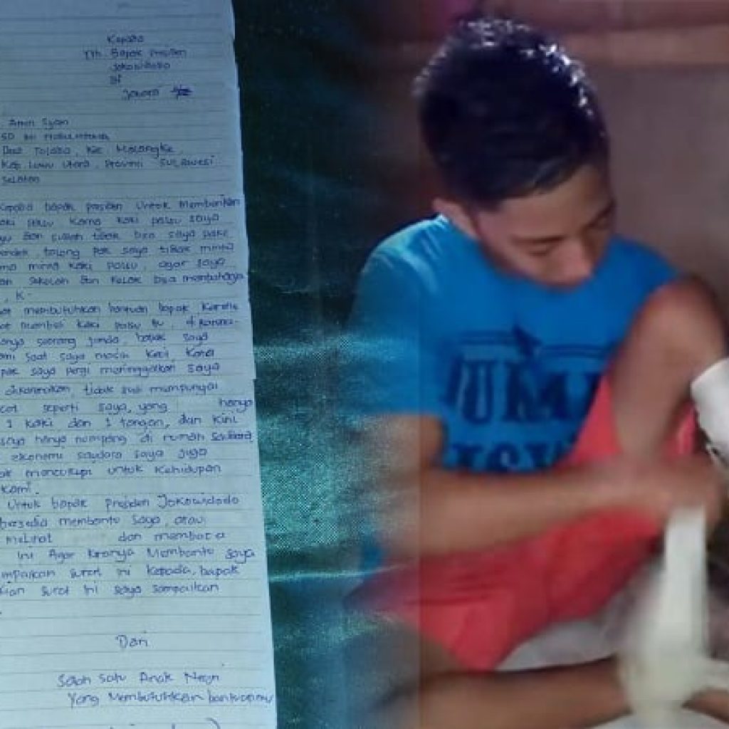 Ingin Kaki Palsu, Anak Ini Buat Surat Untuk Presiden Jokowi