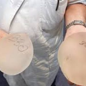 Demi Implan Payudara Kekasih, Pria Ini Tega Curi Uang Kakeknya