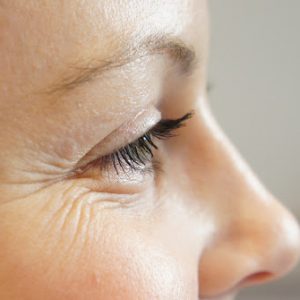 Punya Keriput Di Bawah Mata? Ini Solusi Alaminya