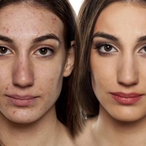 DNA Genomic Perawatan Kecantikan Dengan Air Liur, Berminat?