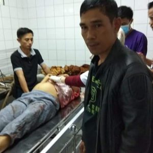 Ibu Hamil Tewas Dibantai Perampok Rumah