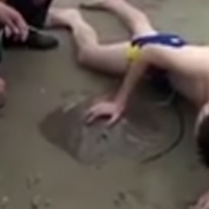 Viral ! Penis Pria Ini Tersengat Ikan Pari Saat Berenang di Laut