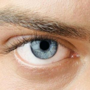 Foto Pria Menangis Darah, Kok Bisa? Ternyata ini penyebabnya