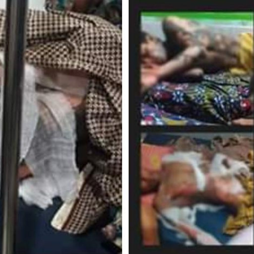 Istri Bakar Suami di Lombok Timur Gara-gara Tak Diberitahu Sandi HP