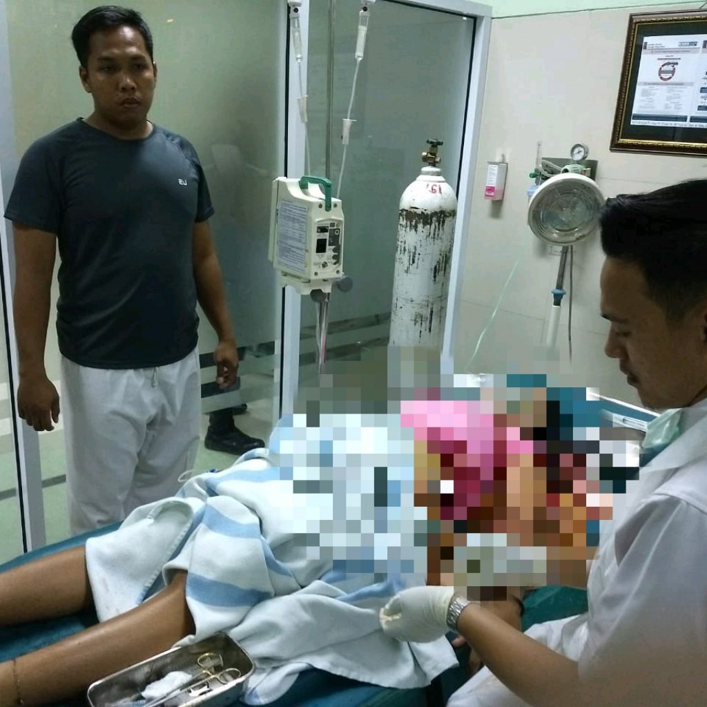 Cinta Diputus Sebelah Pihak, Pemuda Tikam Pacarnya 16 Tusukan