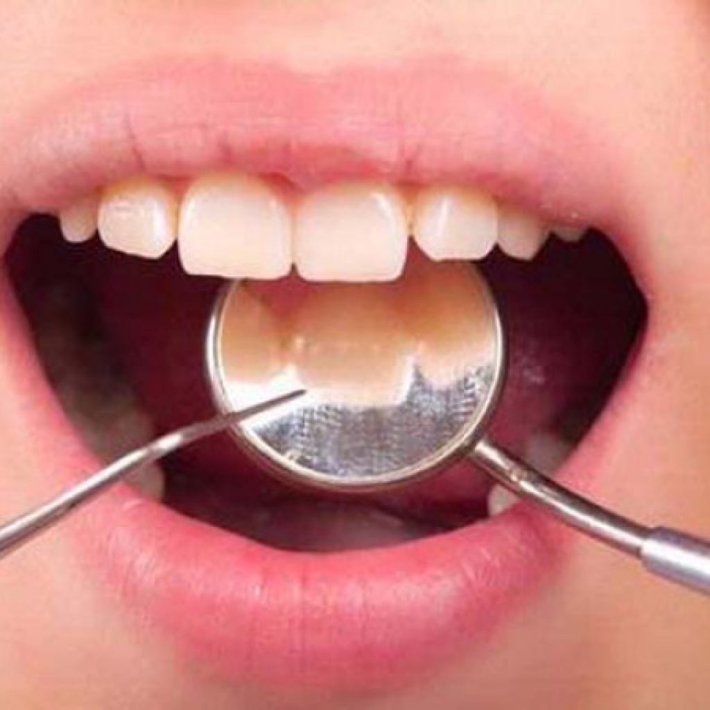 Cara Merawat Mulut dan Gigi Selama Bulan Ramadhan