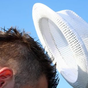 6 Cara Mudah Mengatasi Kulit Kepala Terbakar Matahari