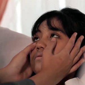 Mengenali Dampak Buruk Anemia pada Tubuh Anda