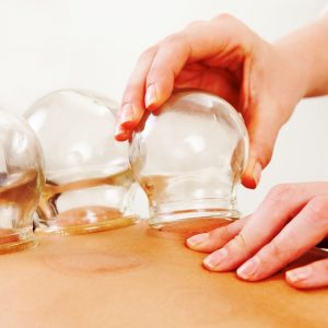 Mengenal Manfaat dan Efek Samping Terapi Bekam