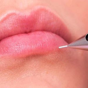 Menyulam Bibir Agar Selalu Tampak Memesona? Baca Dulu Fakta-faktanya di Sini