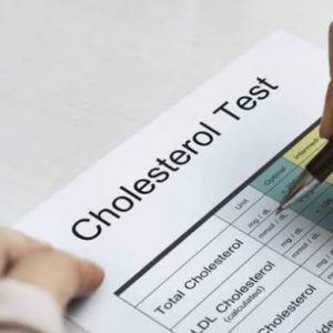 5 Hal yang Tidak Boleh Dilakukan Jika Terkena Kolesterol Tinggi