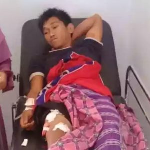 Warga Dempo Selatan Kota Pagaralam Nyaris Tewas Diterkam Harimau