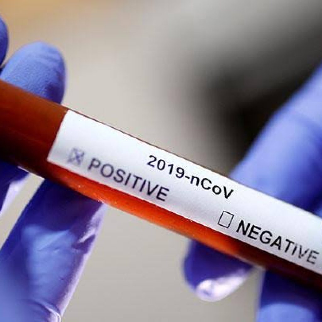 Pasien Positif Corona di Sumsel Bertambah