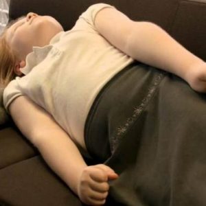 Cepat Kenali Ciri-Ciri Epilepsi yang Paling Umum Terjadi