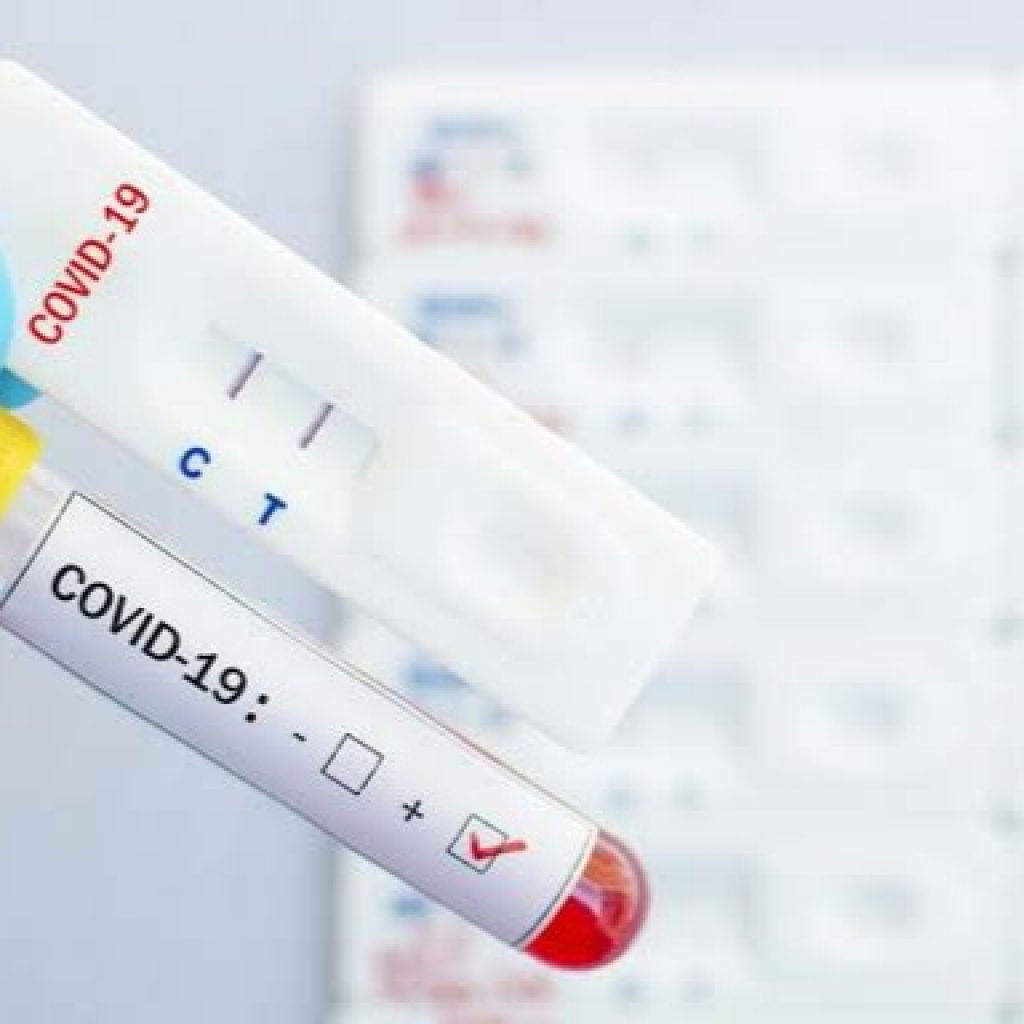 Tiga Warga Palembang Tambah Daftar Pasien Positif Corona di Sumsel Menjadi 22 Kasus