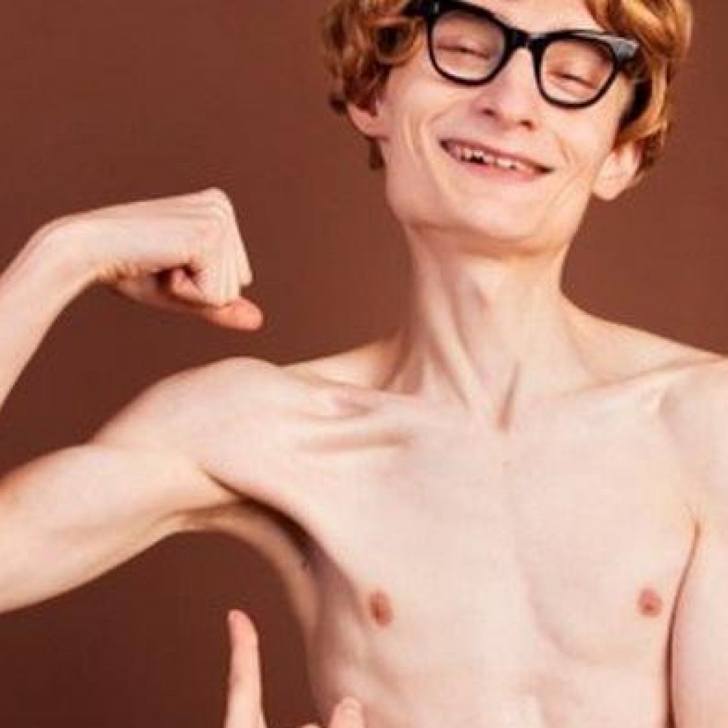 Beberapa  Penyakit Yang Bisa Dialami Orang Kurus