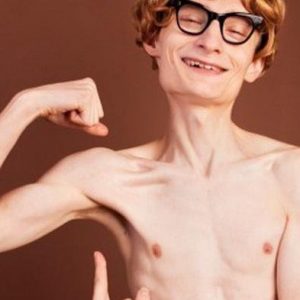 Beberapa  Penyakit Yang Bisa Dialami Orang Kurus