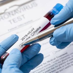 Update 23 April 2020 : Kasus Positif Corona Bertambah Jadi 93 Orang di Sumsel