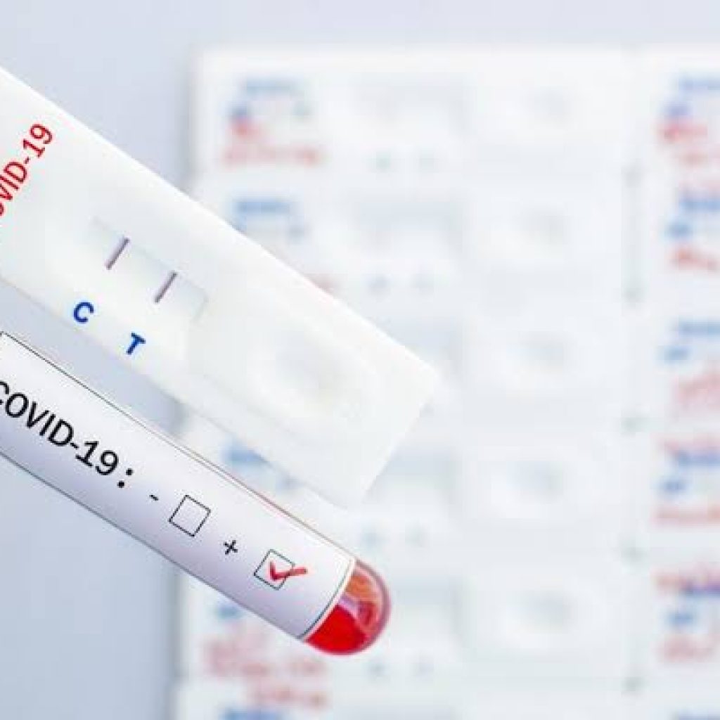 Tiga WNA Jamaah Dakwah di Palembang, Positif Corona Via Rapid Test