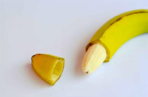 Beberapa Hal Yang Perlu Diketahui Pasca Melakukan Sunat