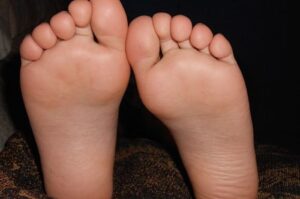 Ini Penyebabnya,Sering Menggoyang-goyangkan Kaki Saat Tidur