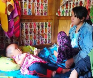 Bayi Penderita Hidrosefalus Dipagaralam, Butuh Uluran Bantuan Dermawan