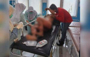 Karyawan PTPN VII Alami Kecelakaan Kerja, Sekujur Tubuh Terkana Luka Bakar