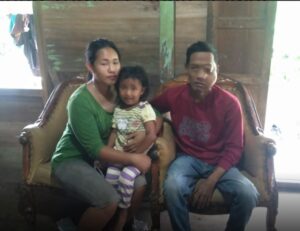 Idap Sakit Tumor, Azwar Berharap Dukungan Pemerintah