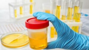 13 Kepala Desa di Lahat Terancam Pemberhentian karena Positif Narkoba