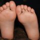 Kaki Sering Semutan? Ternyata Ini Vitamin yang Sering Kurang!